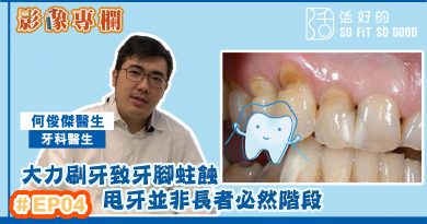 牙科EP04 | 何俊傑醫生