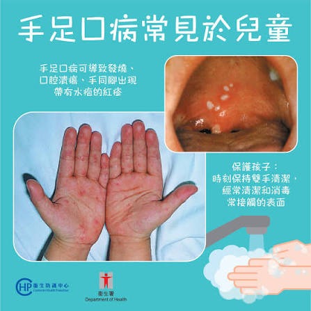 衛生防護中心手足口病講解圖