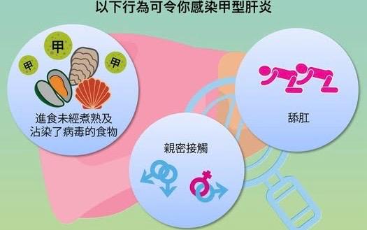 甲型肝炎